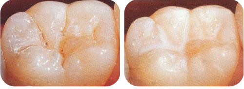Control Odontol�gico de Ni&ntilde;o Sano